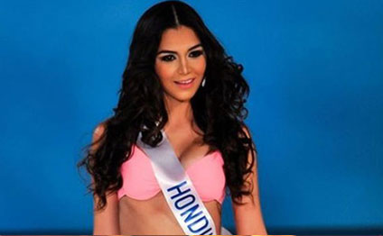 19 yaşlı model ölü tapıldı
