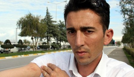 Deputat olmaq istəyən türk model sürücünü döyüb dişlədi