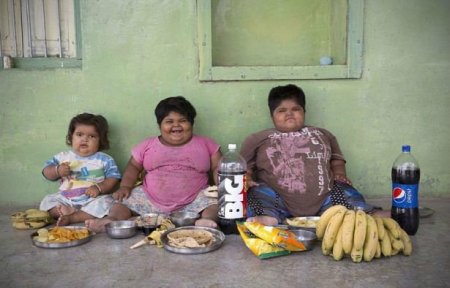 3 yaşında 48 kiloluq uşaq