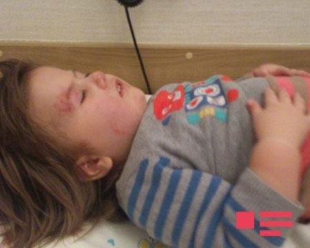 Azərbaycanlı teleaparıcının qızını bağçada bu hala saldılar