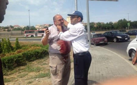 Bakıda dəhşətli qəza: Ata ilə oğul ölümdən döndü
