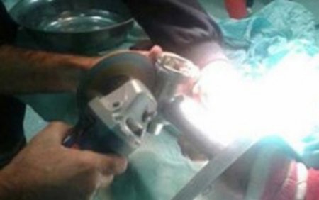 Uşağın əli ətçəkənin içində qaldı