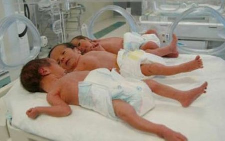 Bakıda 24 yaşlı qadının üçəmləri oldu