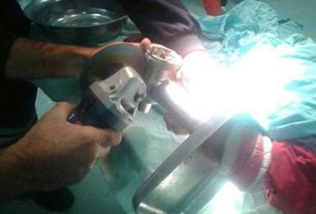 Bakıda uşağın əli ətçəkən maşında qaldı