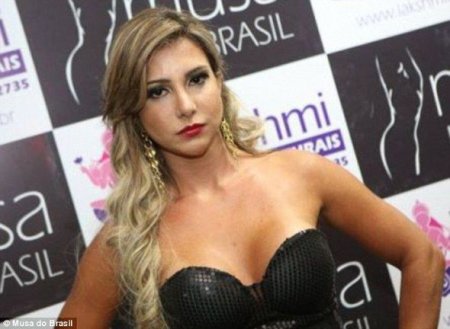 Braziliyalı model plastik əməliyyatdan sonra öldü