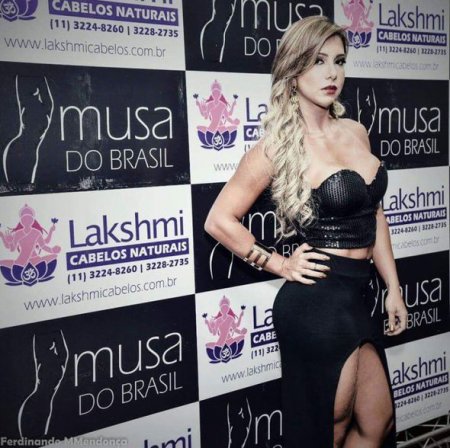 Braziliyalı model plastik əməliyyatdan sonra öldü