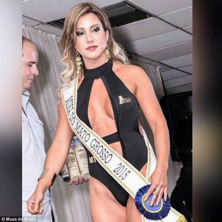 Braziliyalı model plastik əməliyyatdan sonra öldü
