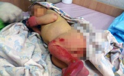 ŞOK! Ana sevgilisi ilə əylənməyə getdi: - 18 aylıq usağı qarışqalar evdə diri-diri yedi