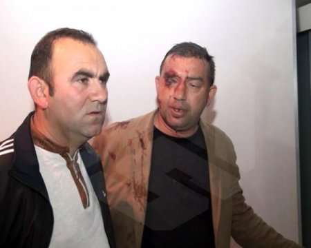 Bərdədə ağır qəza: ölən və yaralananlar var