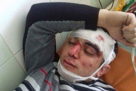 Ermənilər azərbaycanlılara hücum etdi: 6 yaralı Ermənilər azərbaycanlılara hücum etdi: 6 yaralı