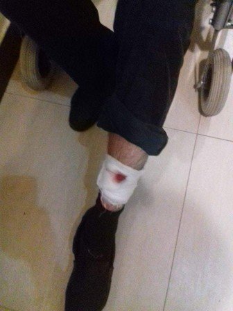 Ermənilər azərbaycanlılara hücum etdi: 6 yaralı Ermənilər azərbaycanlılara hücum etdi: 6 yaralı