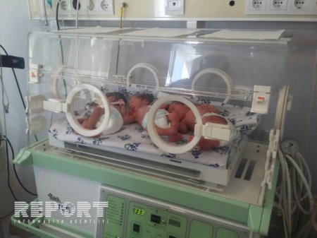 10 ildir övladı olmayan ailənin üçəm qızları dünyaya gəlib