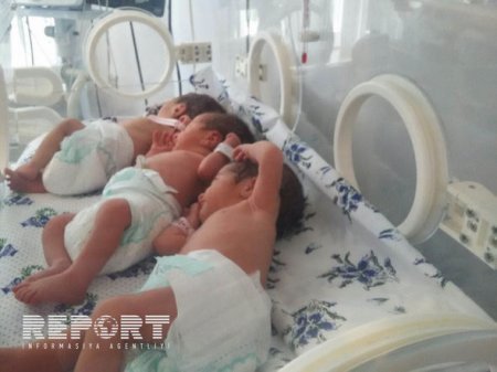 10 ildir övladı olmayan ailənin üçəm qızları dünyaya gəlib