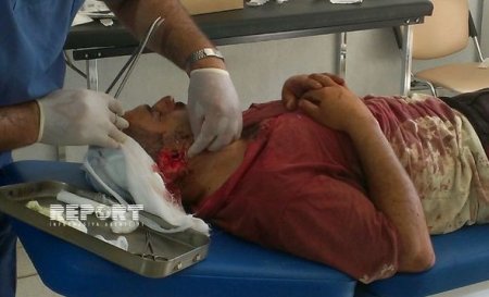 Azərbaycanda kütləvi dava: Bir nəfərin iki qulağını kəsdilər