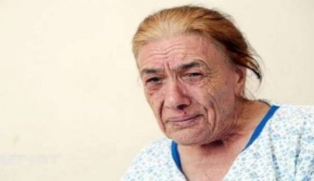 Ayağı səhvən kəsilən qadın dünyasını dəyişdi