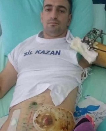 Aprel döyüşlərində yaralanan hərbçimiz kredit borcuna görə çətin durumdadır