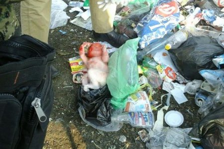 Bakıda zibillikdə tapılan körpənin vəziyyəti düzəlib