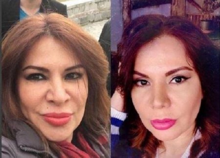 Məşhur aparıcı üzündə eyni anda üç əməliyyat keçirib