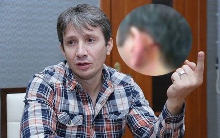 Azər Axşamın qulağı cırıldı