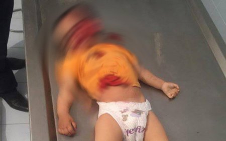 İki yaşlı Zəhranın ürək parçalayan görüntüləri