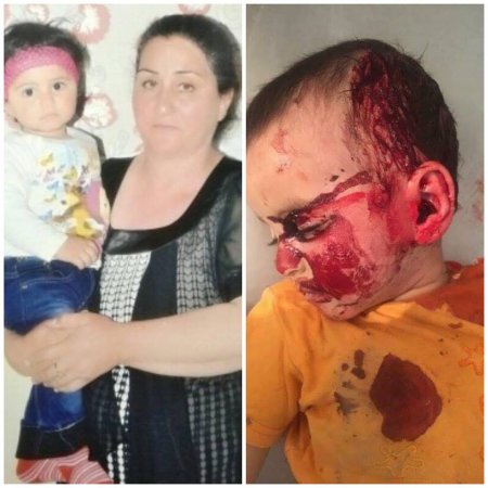 “Artıq ermənilərə qapaz vurmağın vaxtı çatıbdır”