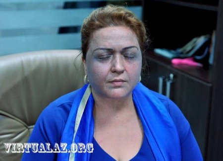Bakıda Salvador Dali hoqqası: Əliyevanı necə qaradəriliyə çevirdilər...