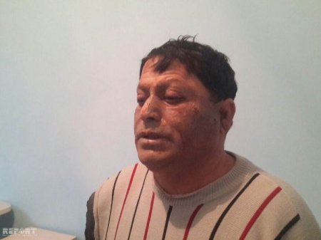 Abşeronda partlayış: 3 nəfər ağır yaralandı