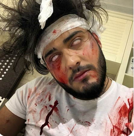 Ayaz Babayev tanınmaz hala düşdü