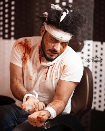 Ayaz Babayev tanınmaz hala düşdü