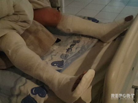 Sumqayıtda yaşayış binasının lifti qırılıb, xəsarət alanlar var