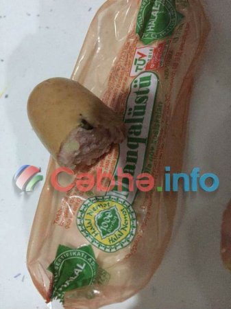 Bəşirovların nəcis, qurd, tük çıxan “Halal nemət, 1000 bərəkət”indən dəhşətli faktlar