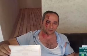 Abşeron başçısının Qarabağ əlilinin qanını tökən qoçularının görüntüləri
