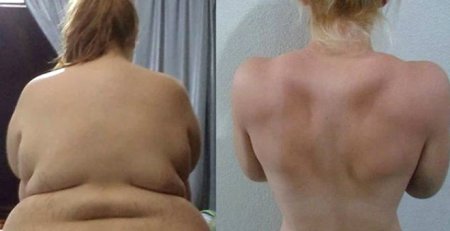 94 kilo arıqlayan qız İnstaqram fenomeninə çevrildi 