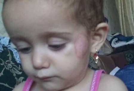 Bağçadakı işgəncəyə görə 2 nəfər işdən çıxarıldı