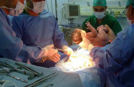 Azərbaycanda daha bir doğuş faciəsi - Ana qeysəriyyə əməliyyatından bir ay sonra öldü