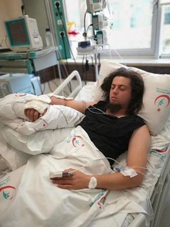 Məşhur azərbaycanlını kobra sancdı: Təcili Misirə aparıldı