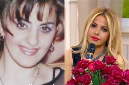 Sərxan Mətanətin estetik əməliyyatdan əvvəlki fotosunu yaydı 
