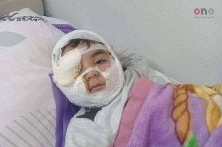 Bakıda sahibsiz itlər problemi təhlükəli miqyas alır